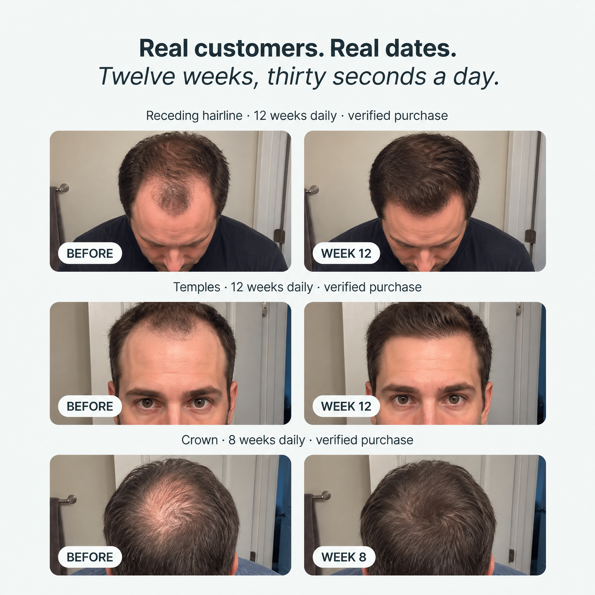 Korea's Viral Brush-On Scalp Serum (PDRN Onto Your Crown & Hairline in 30 Seconds, Not Into Your Hair)